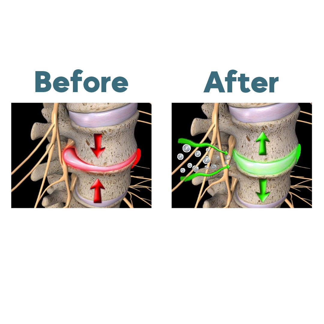 TheraSpine™ Triple Fusion Massager