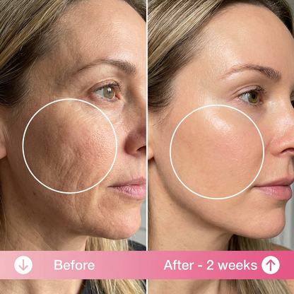 Anti Wrinkle Pillow