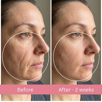 Anti Wrinkle Pillow